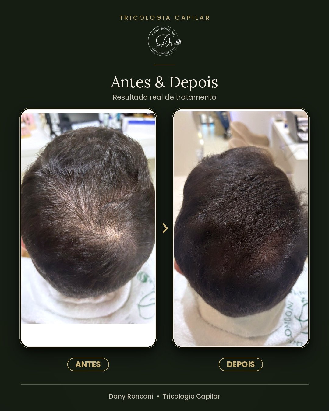 antes_depois_01