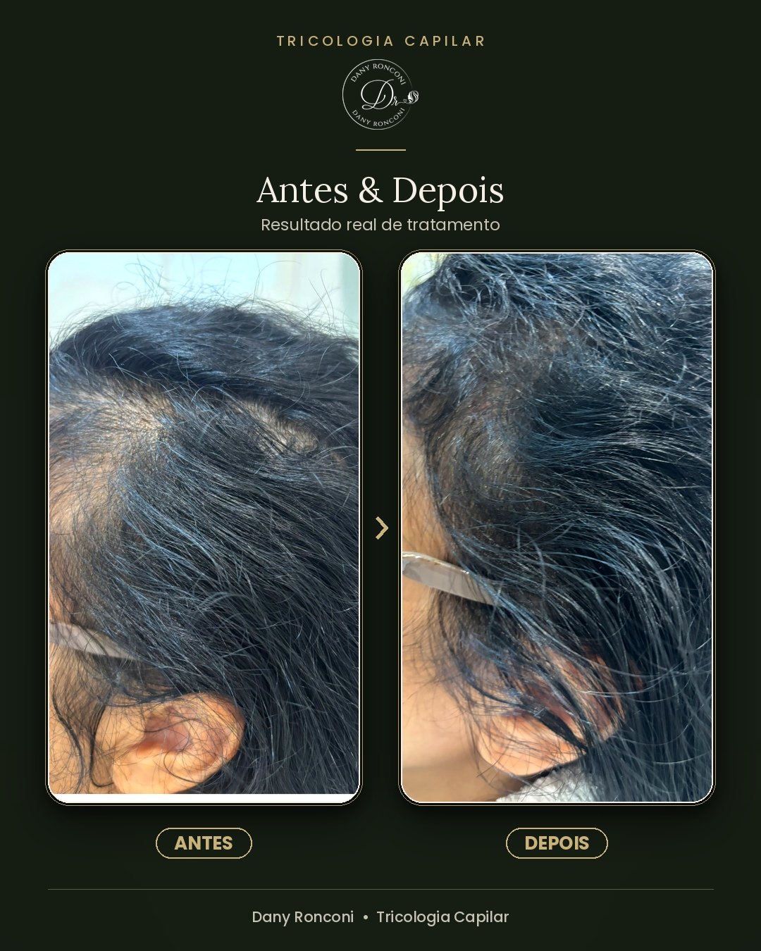 antes_depois_02