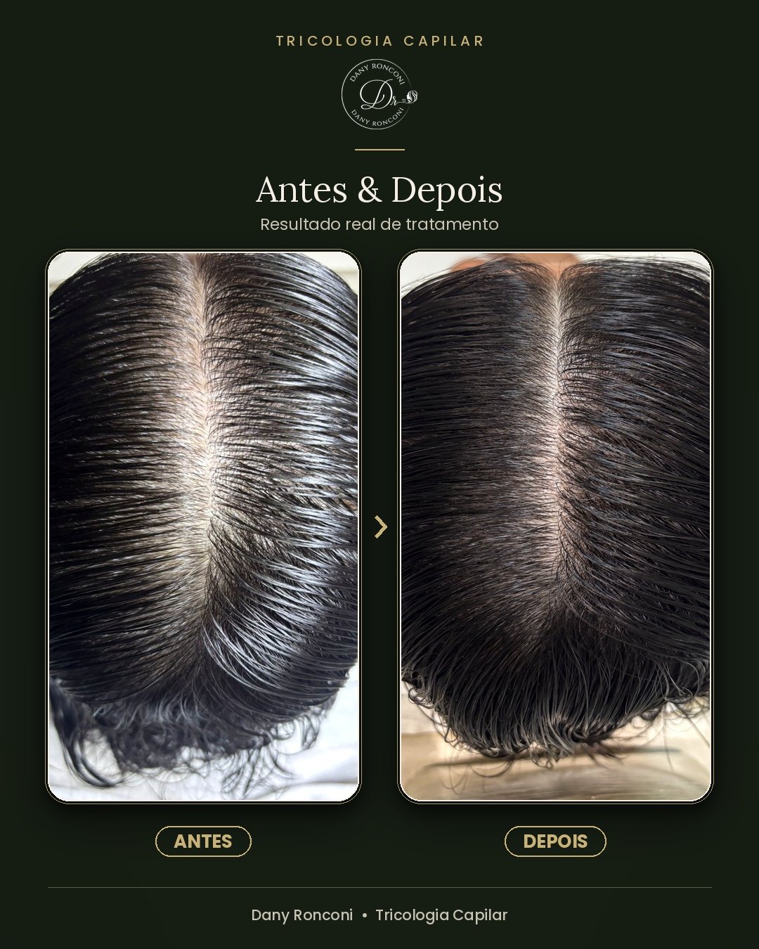 antes_depois_03