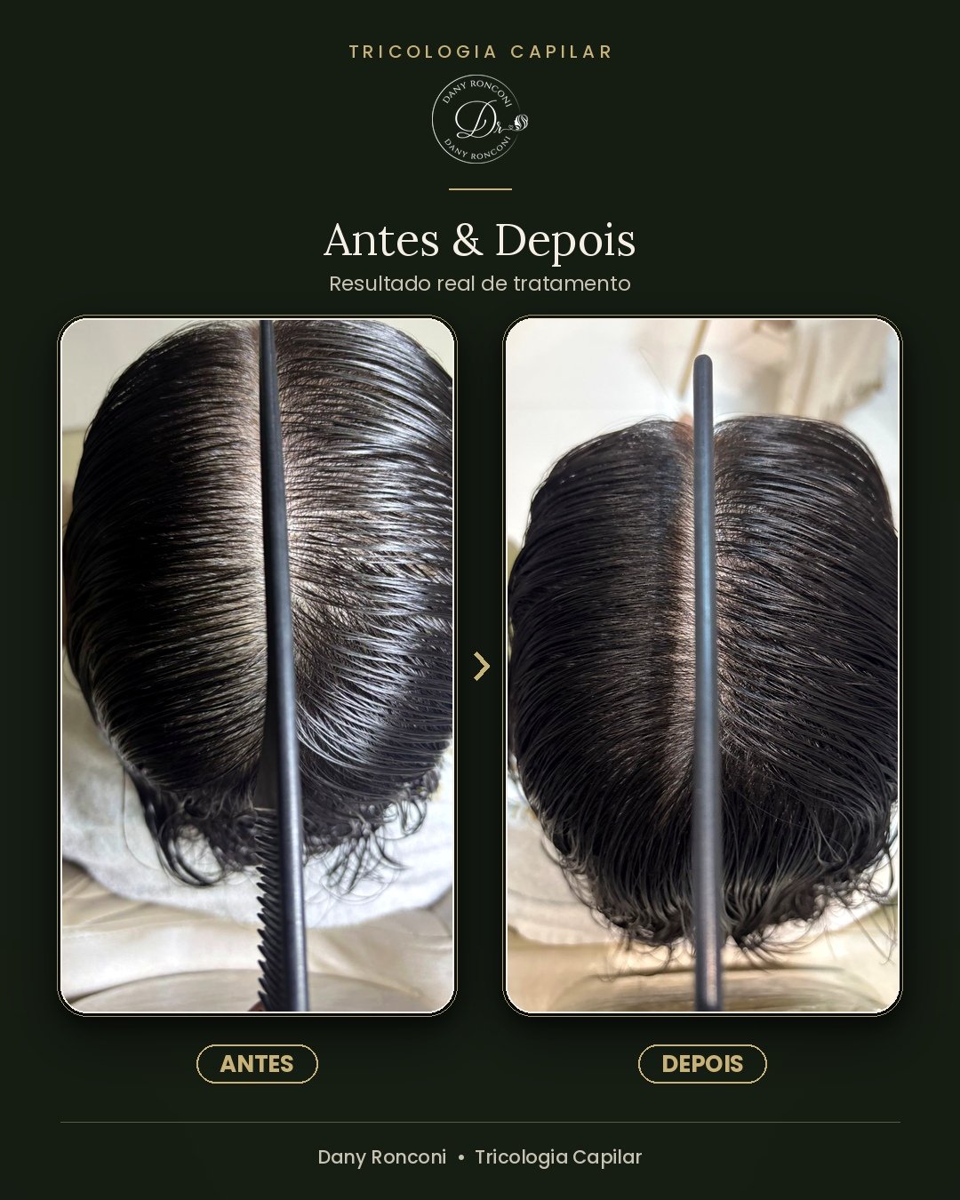 antes_depois_04