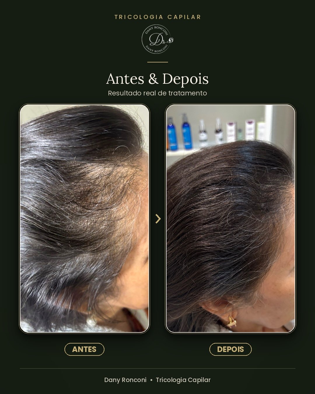 antes_depois_05