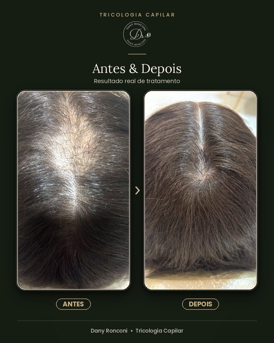 antes_depois_06