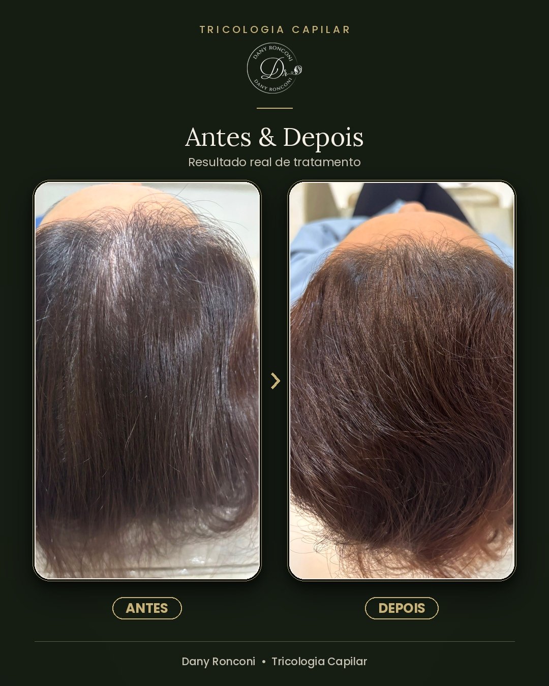 antes_depois_08