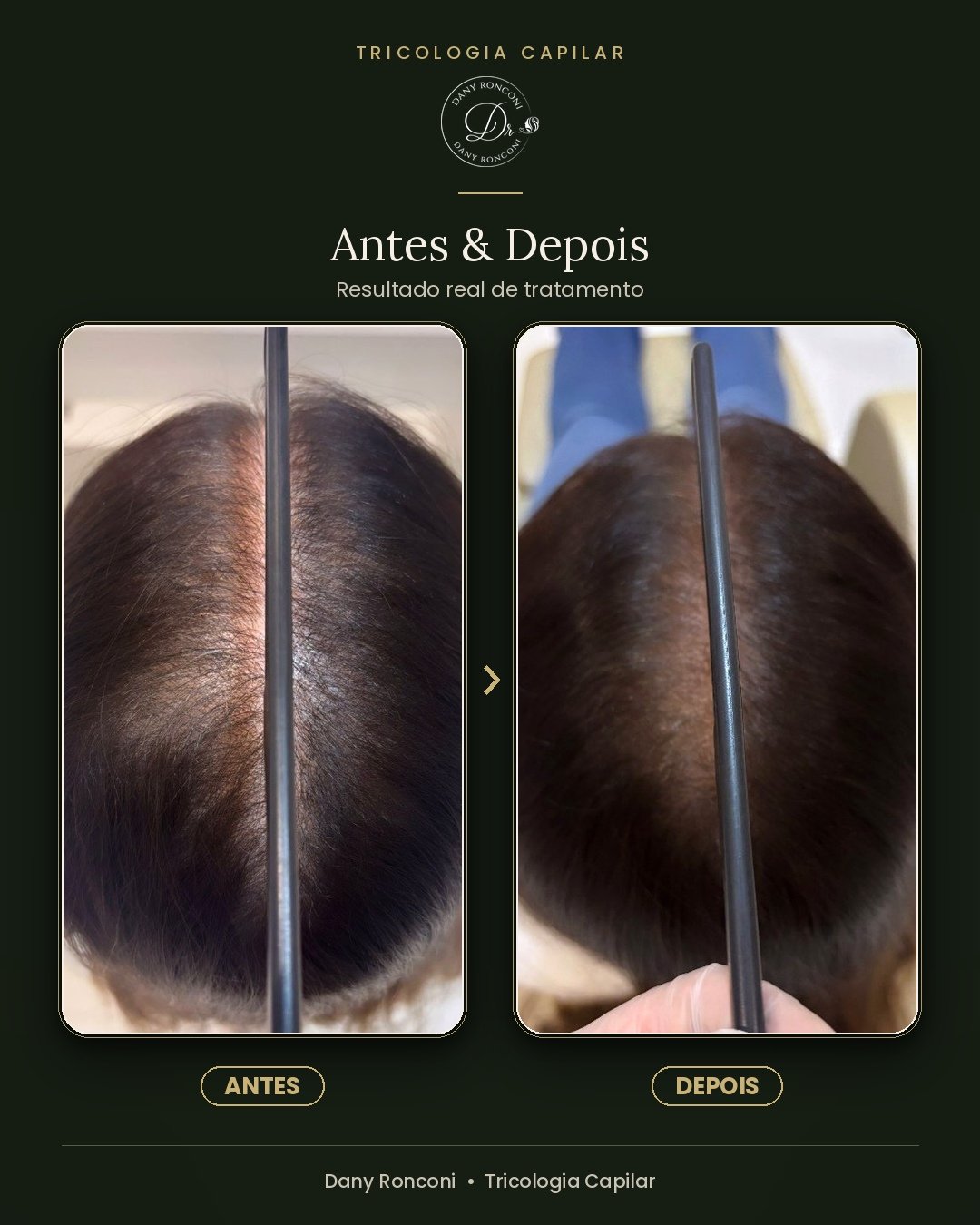 antes_depois_09