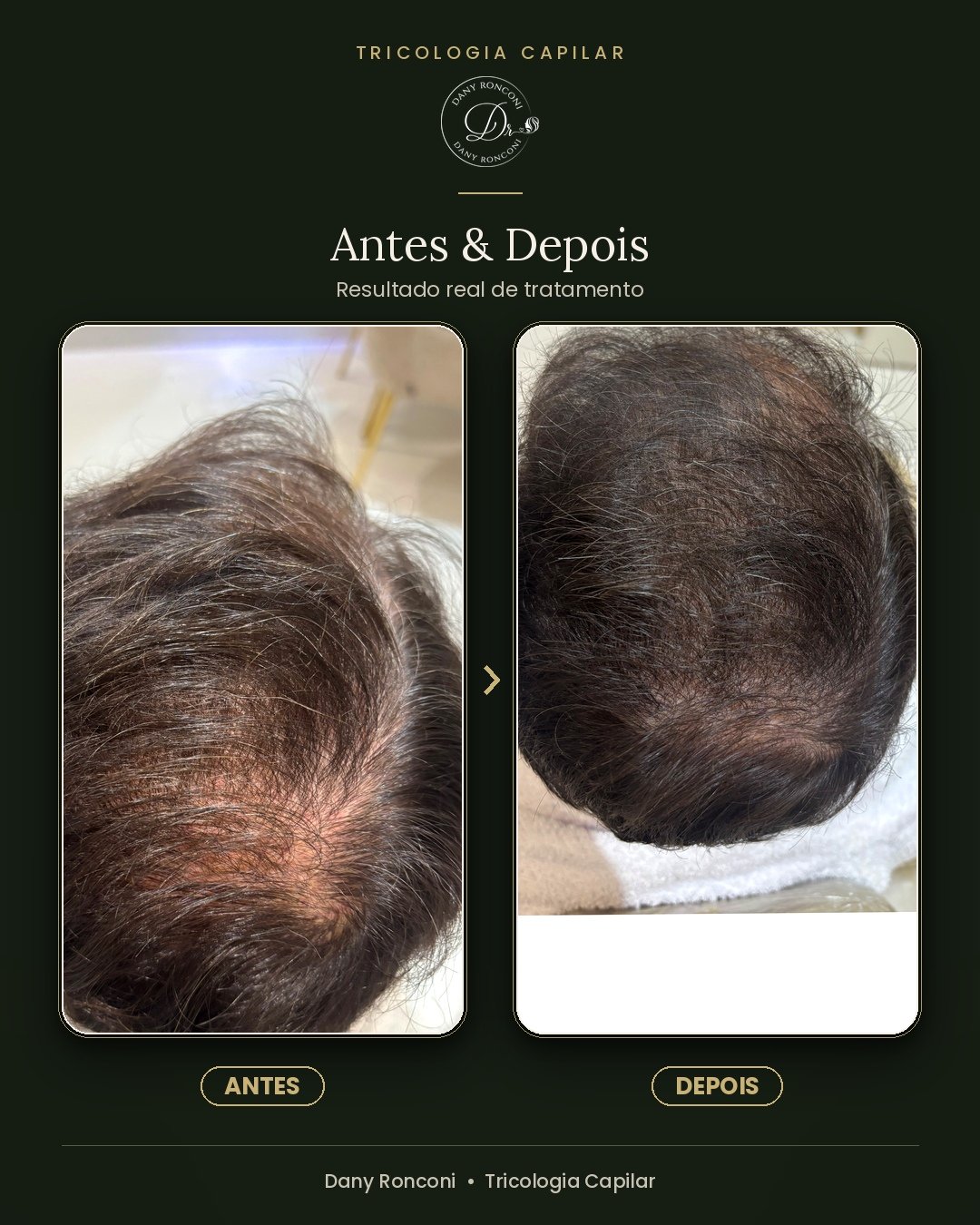 antes_depois_10