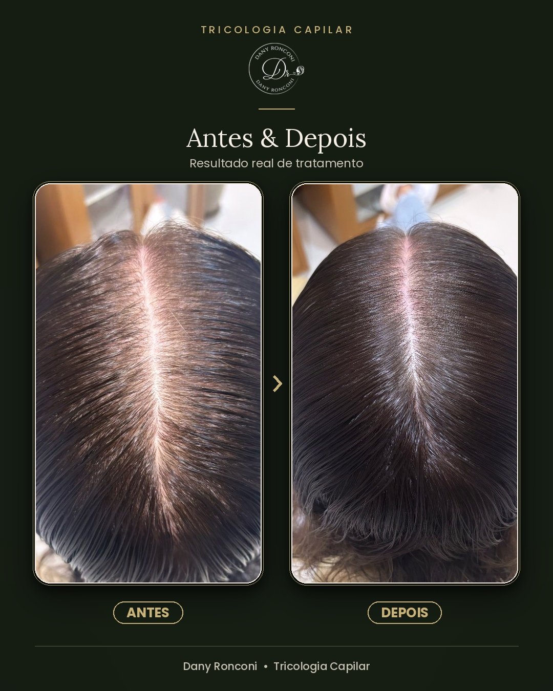 antes_depois_11